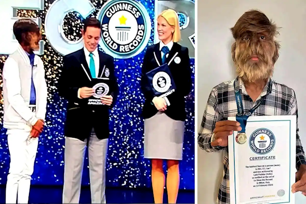 丘巴卡？印度少年獲「臉上最多毛」金氏紀錄臉部毛髮覆蓋超95%