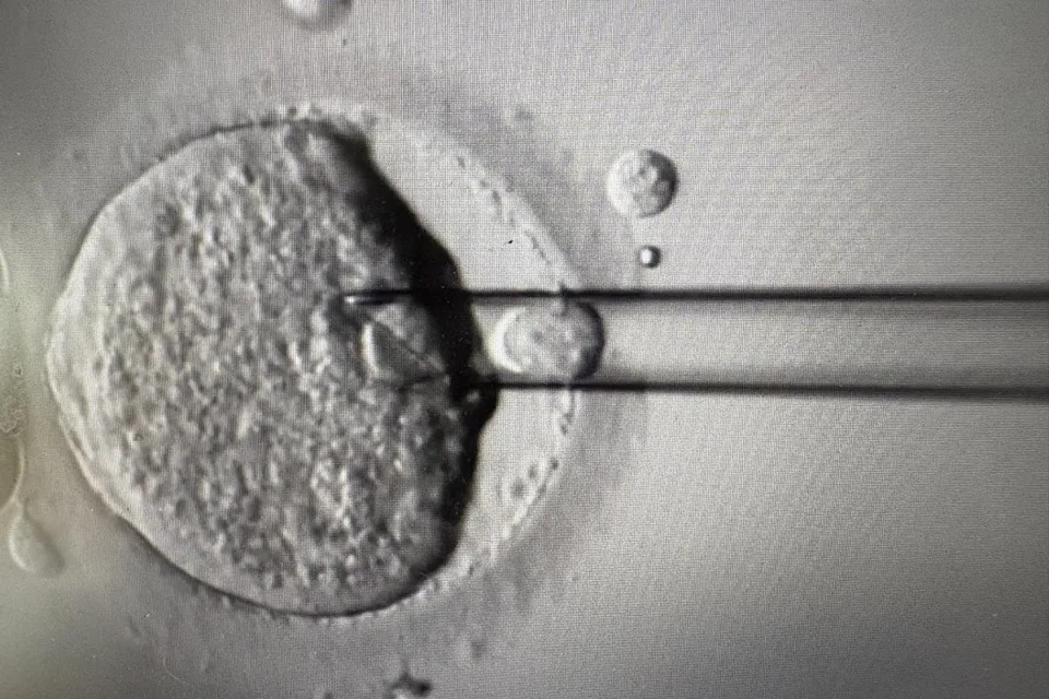 顯微鏡下的卵子與精子結合過程，周圍有小氣泡