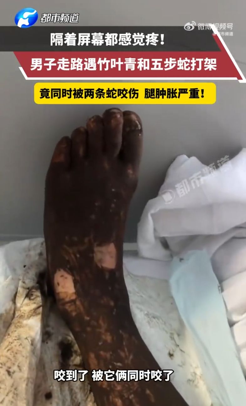 男子遇五步蛇和竹葉青打架被誤傷  同時被兩條蛇咬